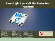 Laser Light Lipo Cellulite Reduction Treatment