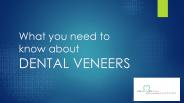 what you need to know about veneers