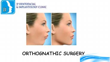 Orthognathic surgery - jpmaxface