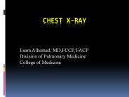 Chest%20X-ray