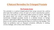 6 Natural Remedies for Enlarged Prostate