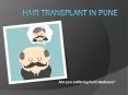 Hair Transplantcost in pune PowerPoint PPT Presentation