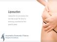 Spill Out Fat with Our Liposuction Treatment in AU PowerPoint PPT Presentation
