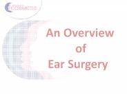 An overview of Ear Surgery