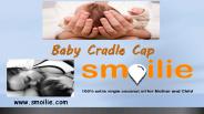 Baby Cradle Cap (1)