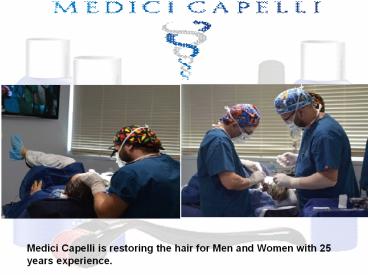 Get Best Hair Loss Treatments at Medici Capelli