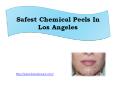 Safest Chemical Peels In Los Angeles PowerPoint PPT Presentation