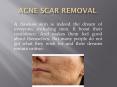 acne scar removal treatment PowerPoint PPT Presentation