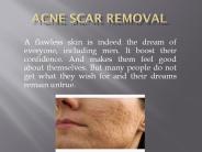 acne scar removal treatment
