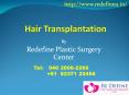 Best Hair Transplantation Cost in Hyderabad | Hair Transplant in Hyderabad PowerPoint PPT Presentation
