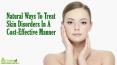 Natural Ways To Treat Skin Disorders In A Cost-Effective Manner PowerPoint PPT Presentation