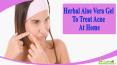 Herbal Aloe Vera Gel To Treat Acne At Home Without Any Side Effects