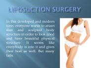 Liposuction surgery for fat removal in Delhi
