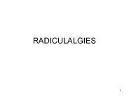 RADICULALGIES