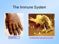 The Immune System PowerPoint PPT Presentation