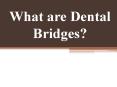 What are Dental Bridges? PowerPoint PPT Presentation