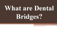 What are Dental Bridges?