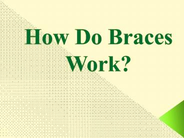 How Do Braces Work?
