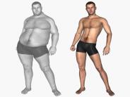All You Need To Know About Liposuction