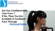 Prognathism