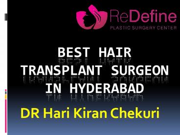 Best Hair Transplantation clinic in Hyderabad