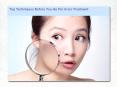 Top Techniques Before You Go For Acne Treatment PowerPoint PPT Presentation