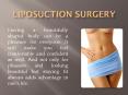 Liposuction surgery for stubborn fat removal PowerPoint PPT Presentation