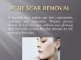 Acne scar removal in Delhi for scar free skin PowerPoint PPT Presentation