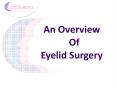 An Overview of Eyelid Surgery PowerPoint PPT Presentation