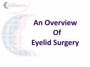 An Overview of Eyelid Surgery