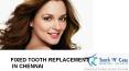 Fixed tooth replacement PowerPoint PPT Presentation