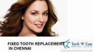 Fixed tooth replacement