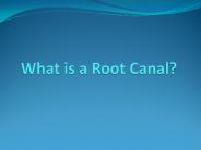 What is a Root Canal?