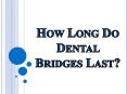 How Long Do Dental Bridges Last? PowerPoint PPT Presentation