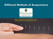 Different Methods of Acupuncture