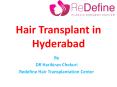 The best hair transplant Surgery in Hyderabad PowerPoint PPT Presentation