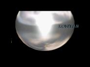 Kontaminanty s