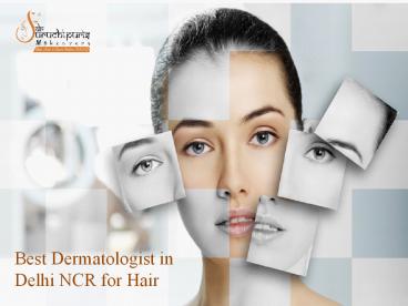 Best Dermatologist in Delhi NCR for Hair