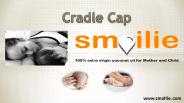 Cradle Cap