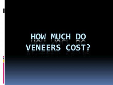 How Much Do Veneers Cost?