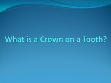 What is a Crown on a Tooth?