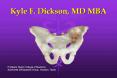 Kyle F. Dickson, MD MBA PowerPoint PPT Presentation