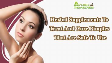 Herbal Supplements To Treat And Cure Pimples That Are Safe To Use