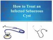 How to Treat an Infected Sebaceous Cyst