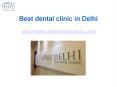 Best Dental Clinic in Delhi - Smile Delhi The Dental Clinic PowerPoint PPT Presentation