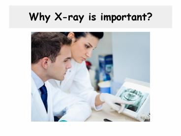 Why x ray is important