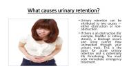 What causes urinary retention?