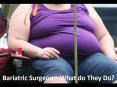 Bariatric Surgeon—What do They Do PowerPoint PPT Presentation