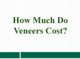 How Much Do Veneers Cost? PowerPoint PPT Presentation