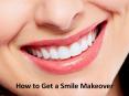 How to Get a Smile Makeover PowerPoint PPT Presentation